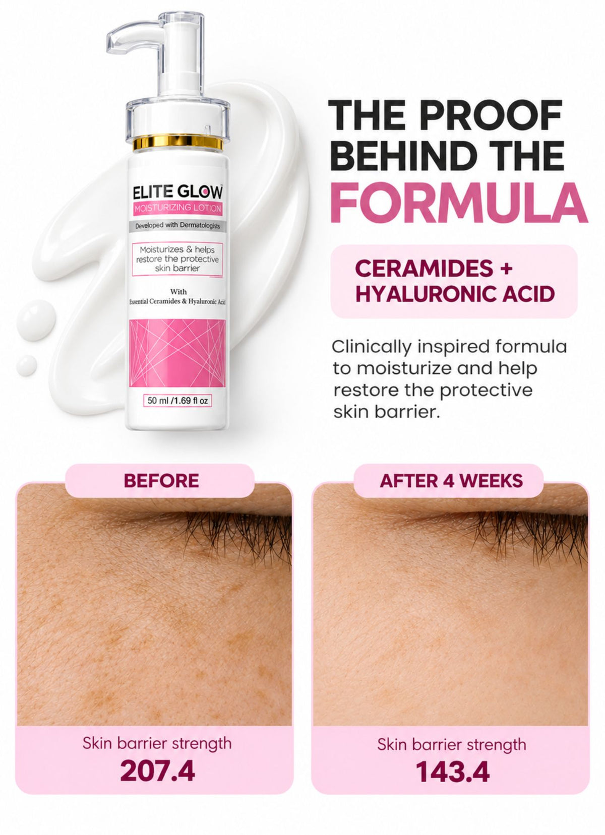 Moisturizing Lotion